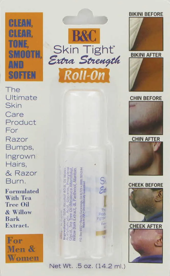 B&C Skin Tight Roll On Razor Bump Solution